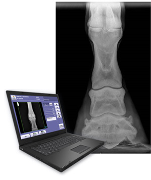 DIGITAL RADIOGRAPH